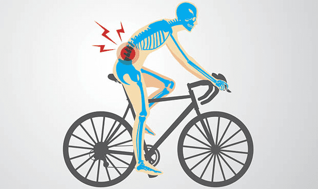Bicycle Riding Good for Sciatica